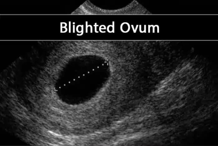 bardari_puch_1705812695_large