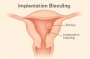 implantation bleeding
